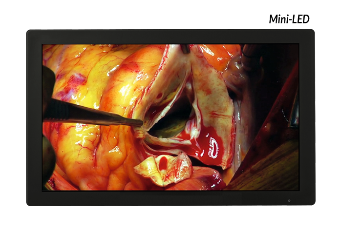 E 31 4K Mini LED 700